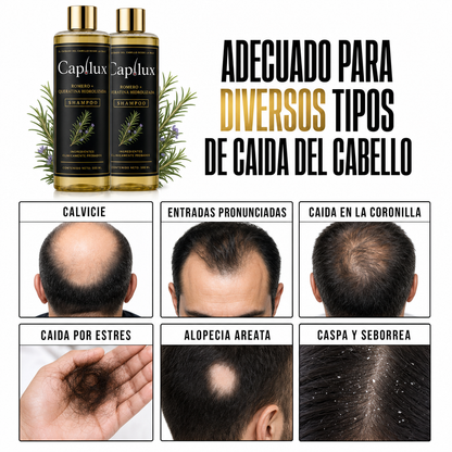 Adecuado para diversos tipos de caída del cabello